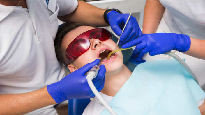 Dental Fillings